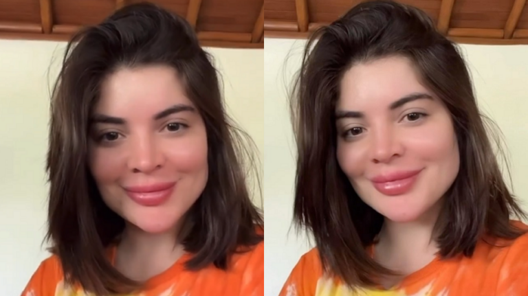 Boca Nova: GKAY reaparece e mostra Reversão de Preenchimento labial